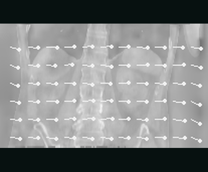 Visualization of the real three-component displacement field, with physical magnitude and sampled in-plane vectors.