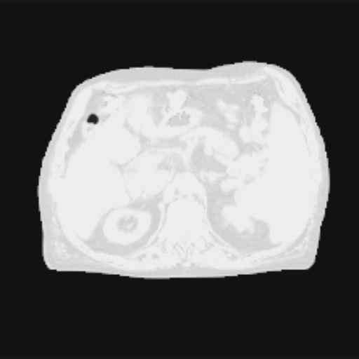 The source after a sampled Contrast augmentation.