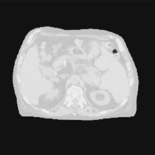 The source after a sampled horizontal Flip augmentation.