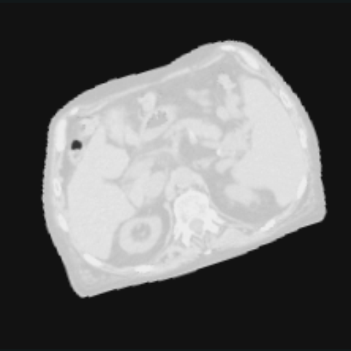 The source after an 18 degree Rotate augmentation.