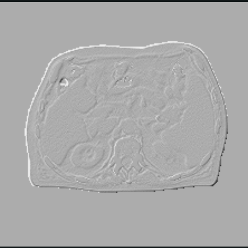 Gradient magnitude output exposing spatial anatomical edges.