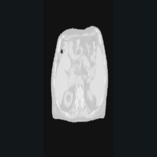 ResampleToResolution output showing the anisotropic target spacing.