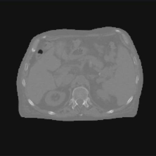 The real abdominal CT source plane before deterministic transforms.